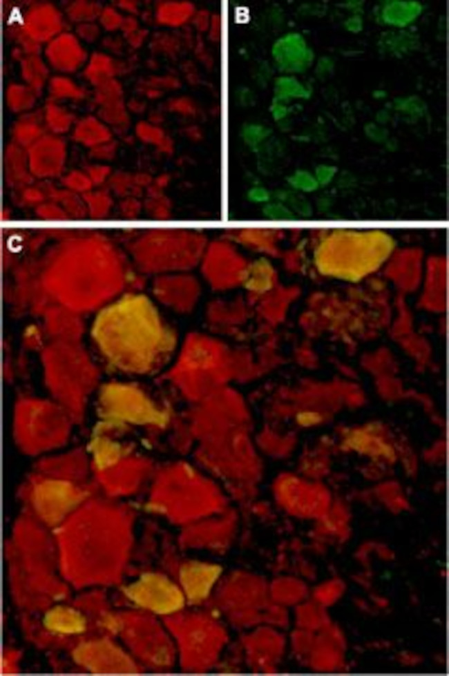 TRPV4 Antibody in Immunohistochemistry (Frozen) (IHC (F))