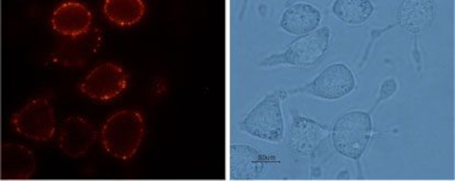 TRPV2 (VRL1) (extracellular) Antibody in Immunocytochemistry (ICC/IF)