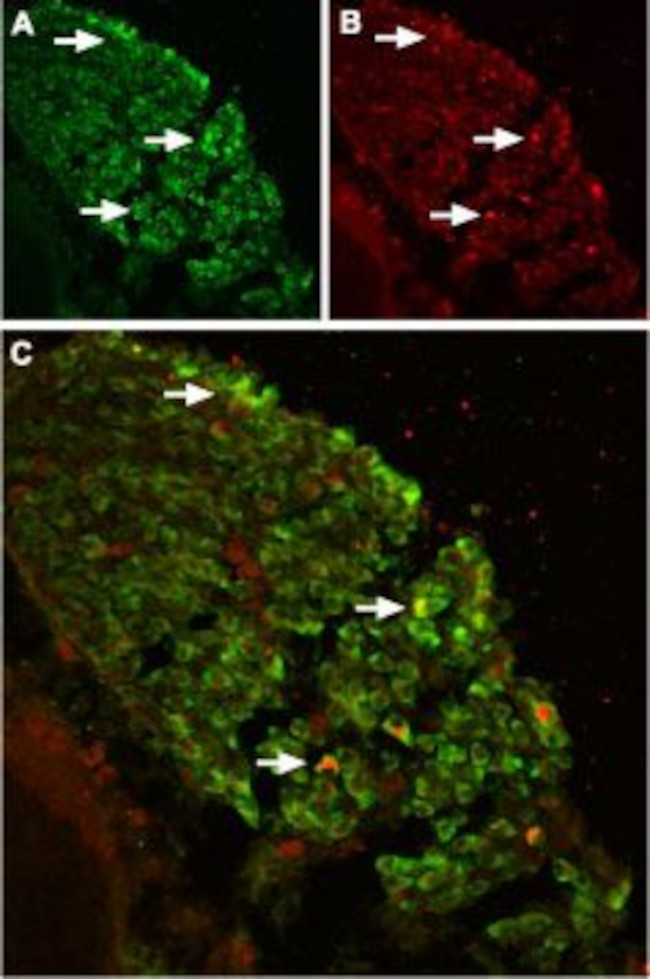 TRPV2 (VRL1) (extracellular) Antibody in Immunohistochemistry (IHC)