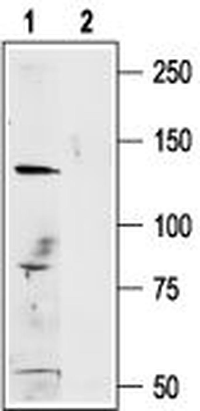 TRPM1 Antibody in Western Blot (WB)