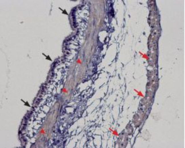 TRPM2 Antibody in Immunohistochemistry (Paraffin) (IHC (P))