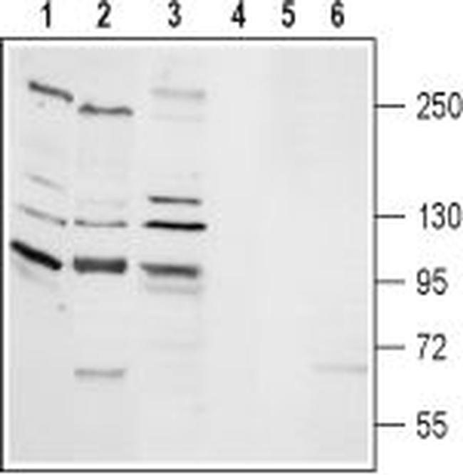 TRPM2 Antibody in Western Blot (WB)