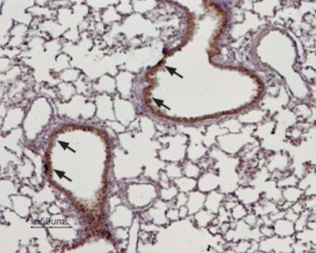 TRPM4 Antibody in Immunohistochemistry (Paraffin) (IHC (P))