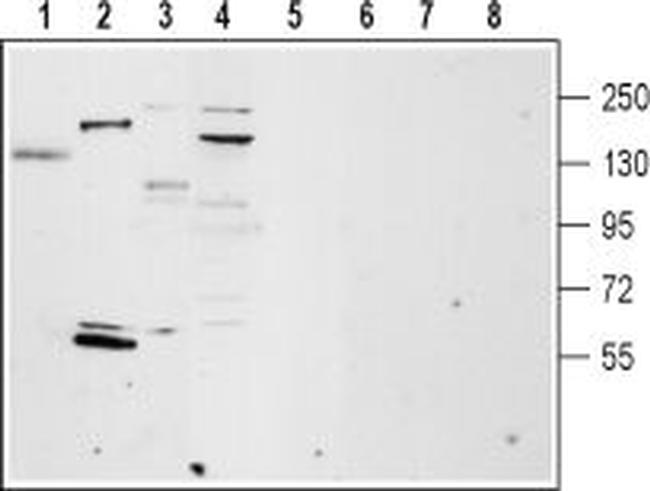 TRPM4 Antibody in Western Blot (WB)