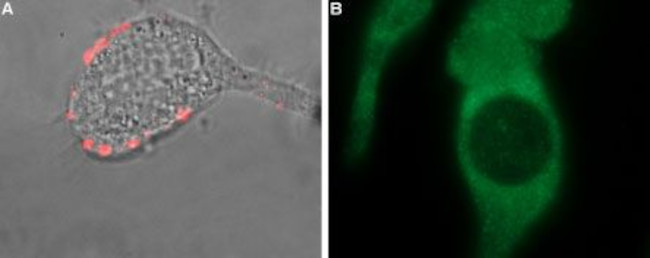 TRPM8 (extracellular) Antibody in Immunocytochemistry (ICC/IF)