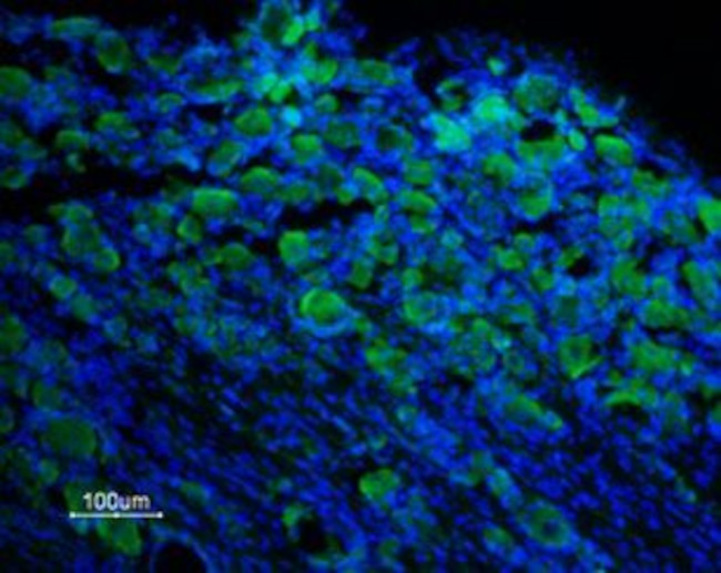 TRPM8 (extracellular) Antibody in Immunohistochemistry (Frozen) (IHC (F))