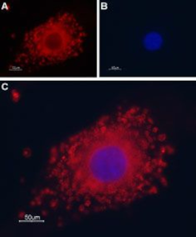 TRPP1 (PKD2) Antibody in Immunocytochemistry (ICC/IF)