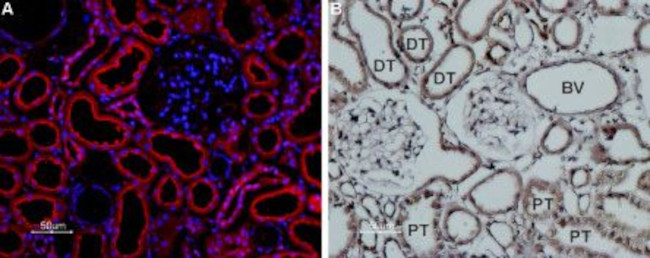 TRPP1 (PKD2) Antibody in Immunohistochemistry (Paraffin) (IHC (P))