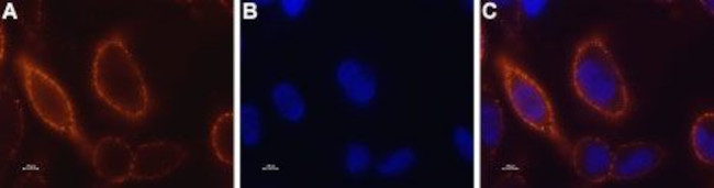 STIM1 (extracellular) Antibody in Immunocytochemistry (ICC/IF)