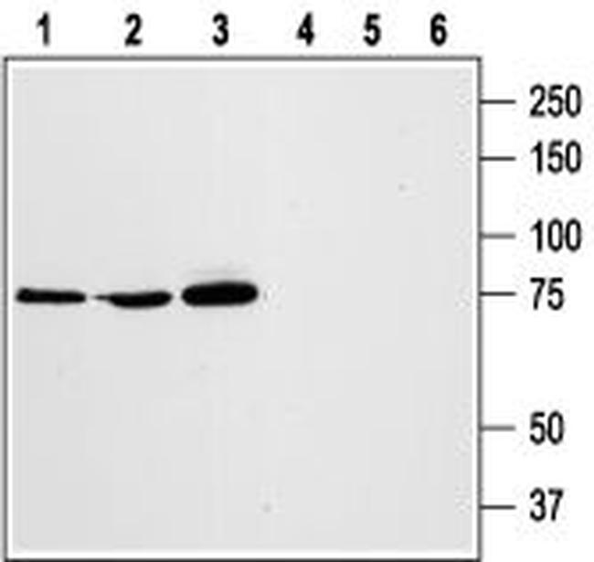 STIM1 (extracellular) Antibody in Western Blot (WB)