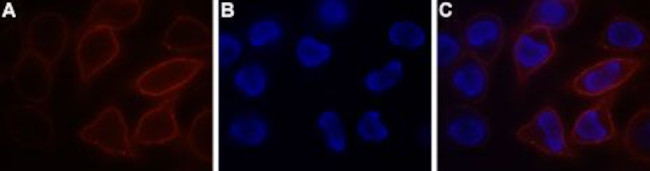 STIM1 (extracellular) Antibody in Immunocytochemistry (ICC/IF)