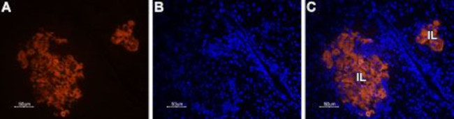 STIM1 (extracellular) Antibody in Immunohistochemistry (Paraffin) (IHC (P))