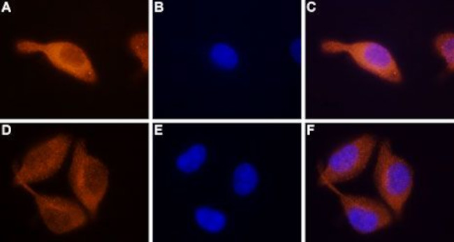 STIM2 Antibody in Immunocytochemistry (ICC/IF)