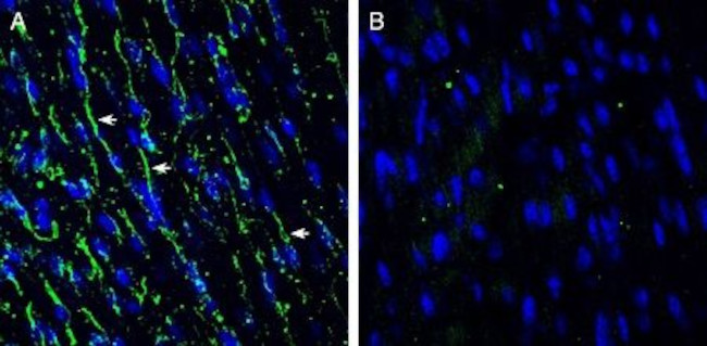 TMEM66 Antibody in Immunohistochemistry (Frozen) (IHC (F))