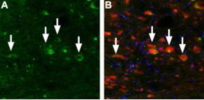 TRPML3 (Mucolipin 3) Antibody in Immunohistochemistry (IHC)