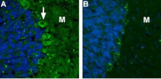 CACNA2D2 (CaV alpha 2 delta 2) (extracellular) Antibody in Immunohistochemistry (IHC)