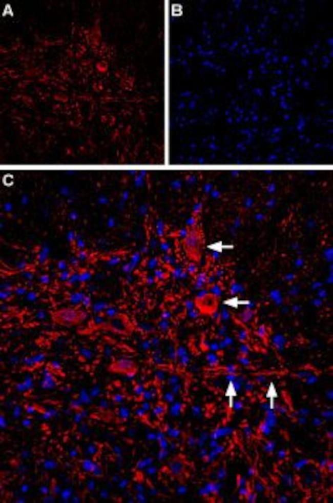 IP3 Receptor-2 (ITPR2) Antibody in Immunohistochemistry (IHC)