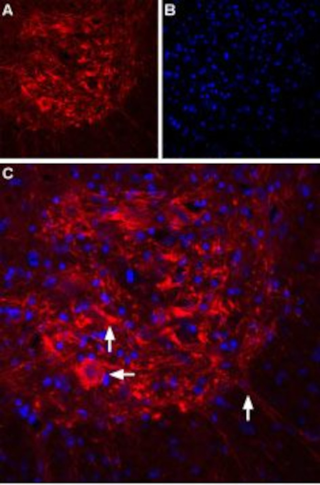 IP3 Receptor-2 (ITPR2) Antibody in Immunohistochemistry (IHC)