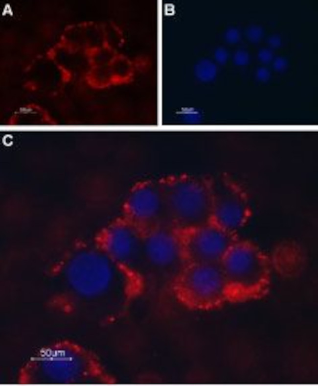 TRPC1 (extracellular) Antibody in Immunocytochemistry (ICC/IF)