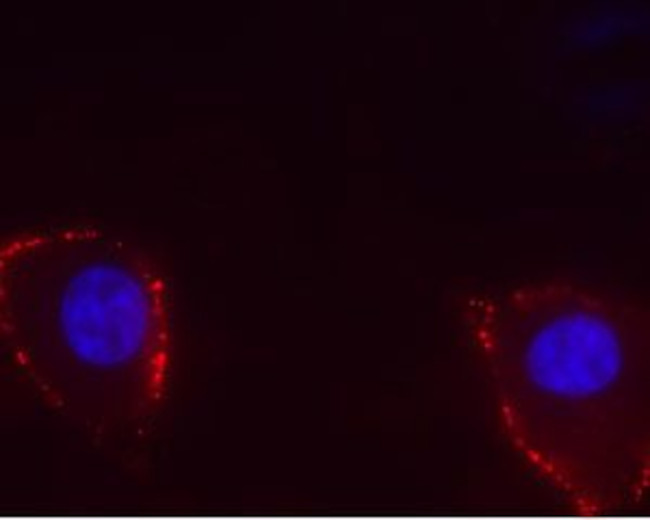 TRPV4 (extracellular) Antibody in Immunocytochemistry (ICC/IF)