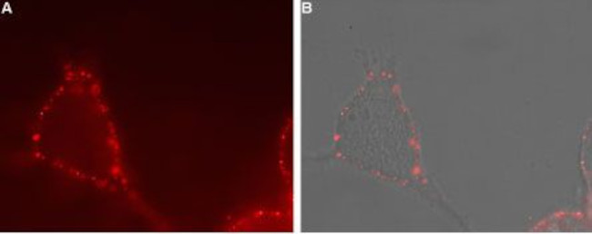 TRPV4 (extracellular) Antibody in Immunocytochemistry (ICC/IF)