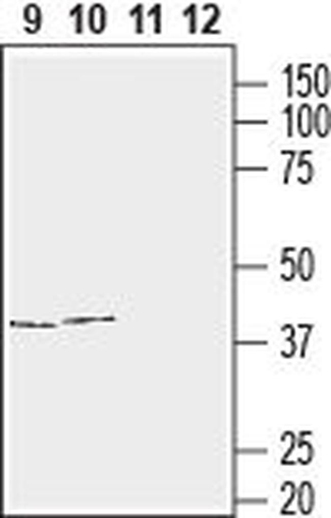 Connexin-43 Antibody in Western Blot (WB)