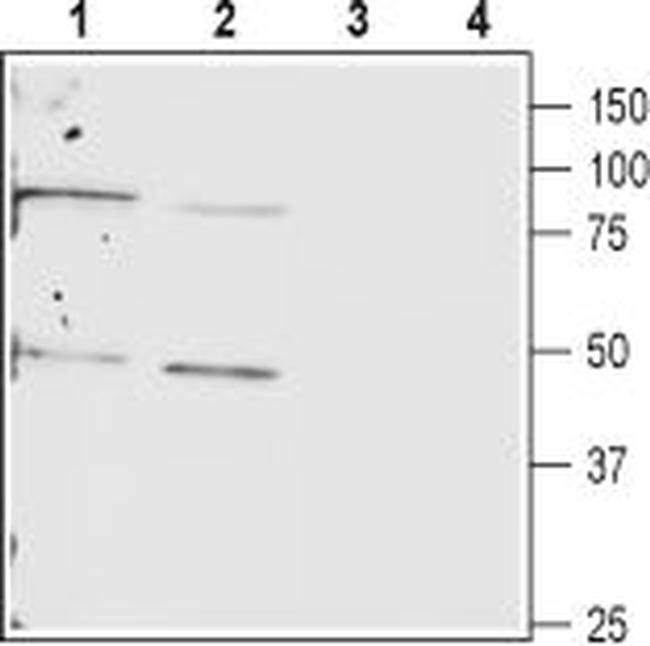 Connexin-40 (GJA5) Antibody in Western Blot (WB)