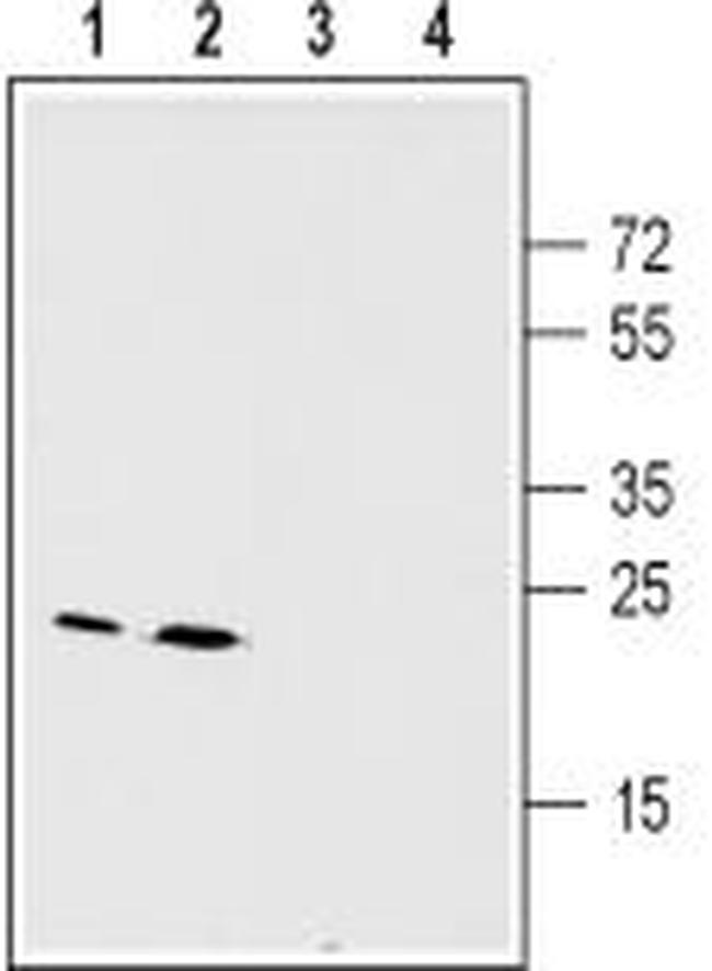 Connexin-26 (GJB2) Antibody in Western Blot (WB)