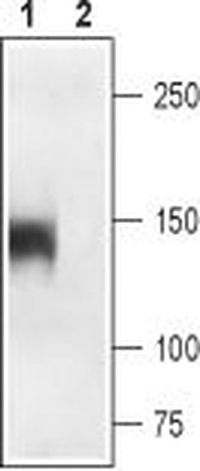 CaV1.1 (CACNA1S) (extracellular) Antibody in Western Blot (WB)