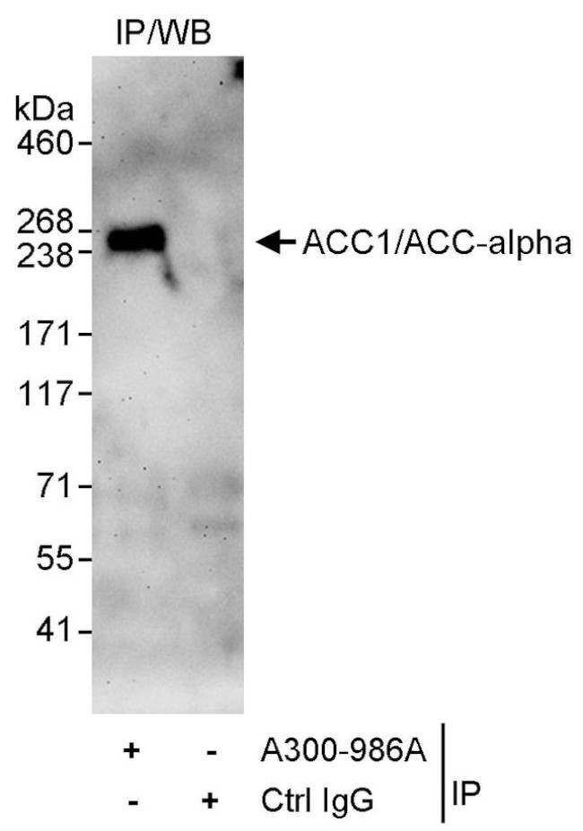 ACC1/ACC-alpha Antibody in Immunoprecipitation (IP)