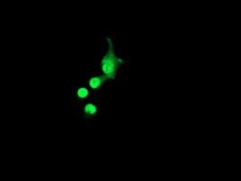 ACD Antibody in Immunocytochemistry (ICC/IF)