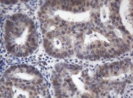 ACD Antibody in Immunohistochemistry (Paraffin) (IHC (P))