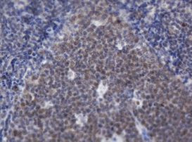 ACD Antibody in Immunohistochemistry (Paraffin) (IHC (P))