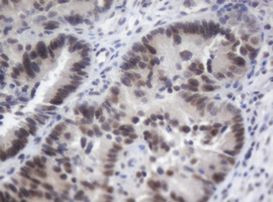 ACD Antibody in Immunohistochemistry (Paraffin) (IHC (P))