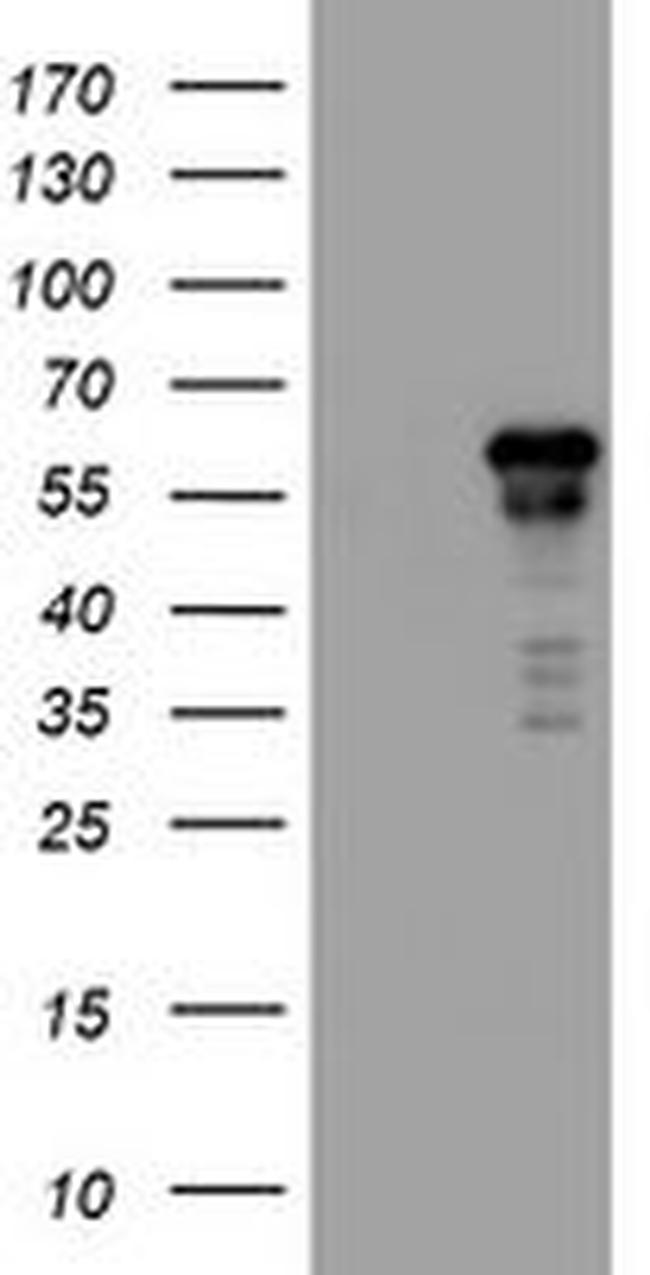 ACD Antibody in Western Blot (WB)