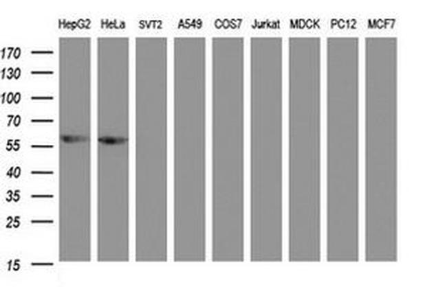 ACD Antibody in Western Blot (WB)