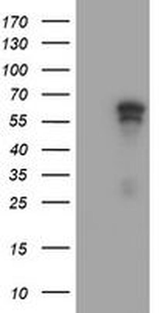 ACD Antibody in Western Blot (WB)