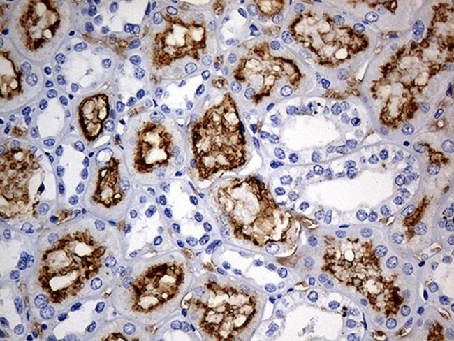 ACE Antibody in Immunohistochemistry (Paraffin) (IHC (P))