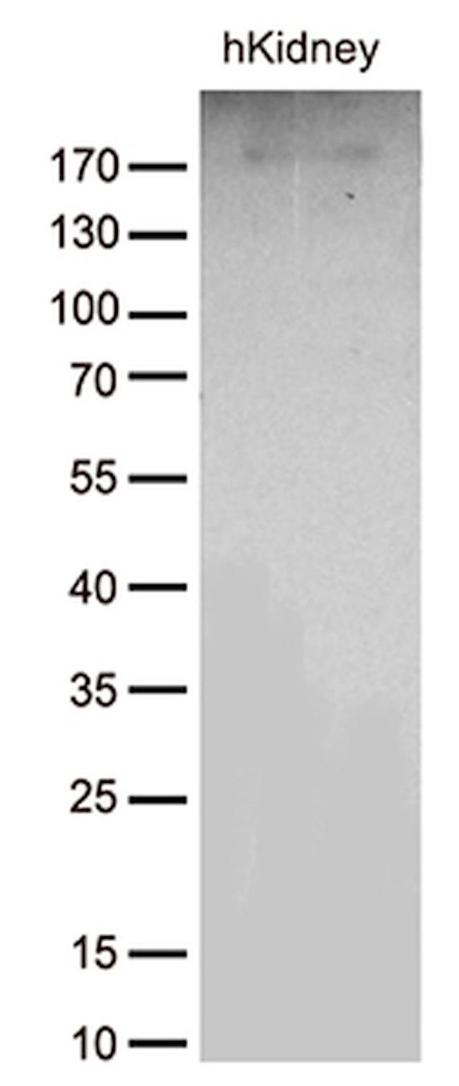 ACE Antibody in Western Blot (WB)