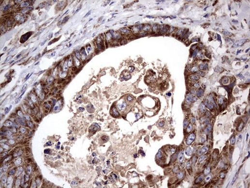 ACE2 Antibody in Immunohistochemistry (Paraffin) (IHC (P))