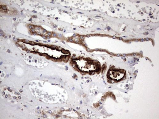 ACE2 Antibody in Immunohistochemistry (Paraffin) (IHC (P))