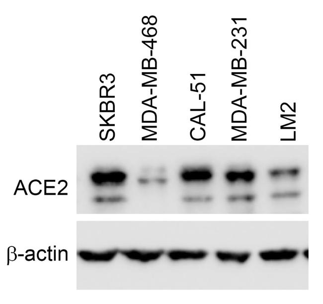 ACE2 Antibody in Western Blot (WB)