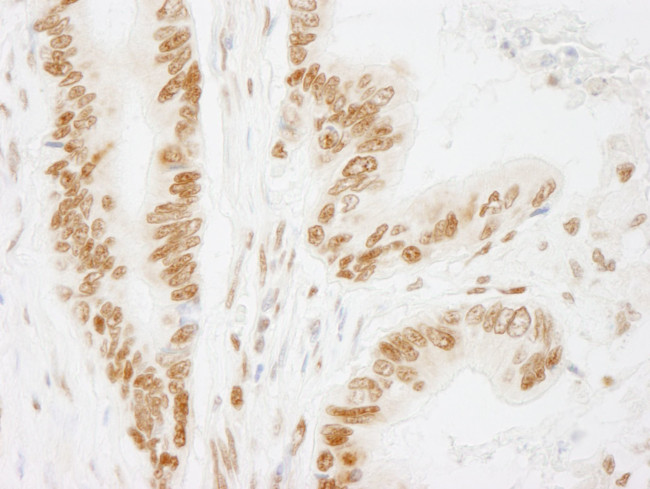 ACINUS/ACN1 Antibody in Immunohistochemistry (IHC)