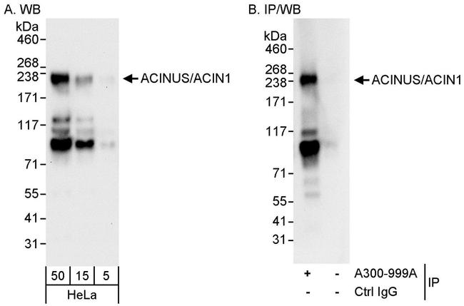 ACINUS/ACN1 Antibody in Western Blot (WB)