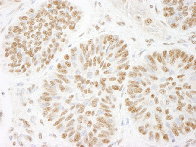 ACINUS/ACN1 Antibody in Immunohistochemistry (IHC)