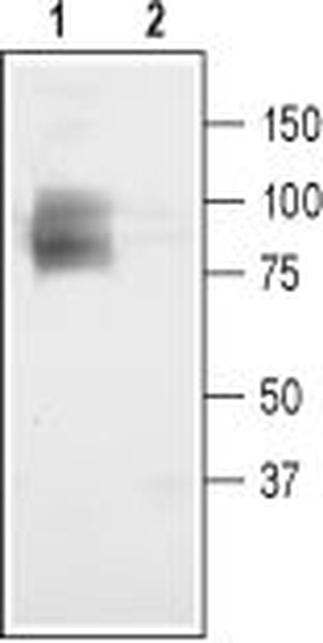 CLC-3 (CLCN3) Antibody in Western Blot (WB)