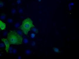 ACLY Antibody in Immunocytochemistry (ICC/IF)