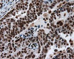 ACLY Antibody in Immunohistochemistry (Paraffin) (IHC (P))