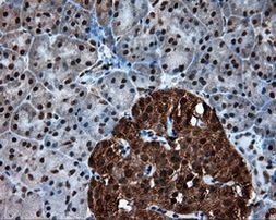 ACLY Antibody in Immunohistochemistry (Paraffin) (IHC (P))