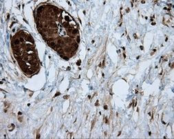 ACLY Antibody in Immunohistochemistry (Paraffin) (IHC (P))